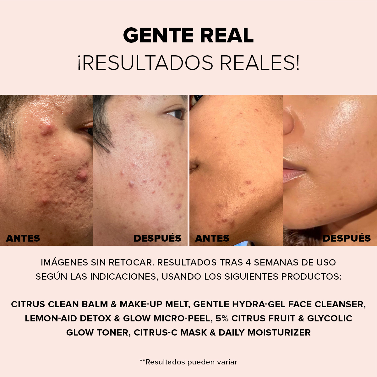 NUDESKIN LEMON-AID DETOX & GLOW MICRO-PEEL (EXFOLIANTE FACIAL)
